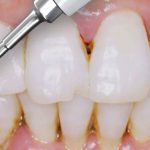 Scaling-Procedure-Demonstration (1)