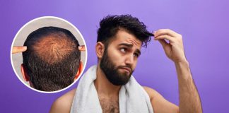 Rambut Mula Gugur? Amalkan 5 Petua Ini Untuk Elak Kepala Botak