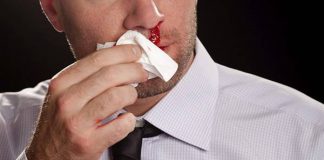 Udara Yang Terlampau Sejuk Atau Kering Punca Pendarahan Hidung, Ini Cara Rawatannya