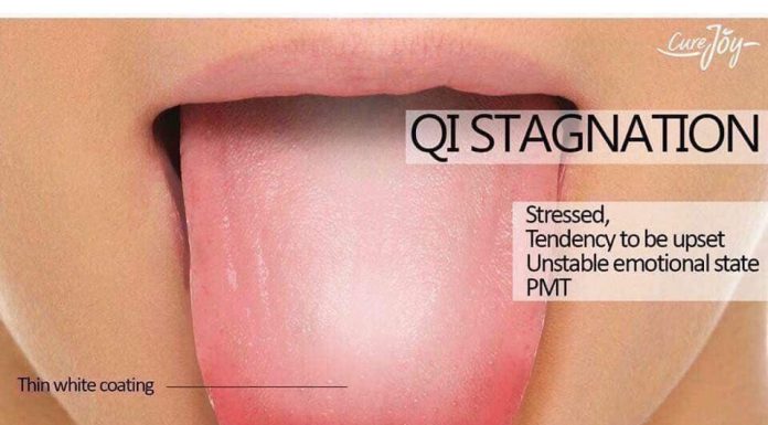 Selaput Putih Yang Tebal, Fahami Warna Lidah Anda! - MASKULIN