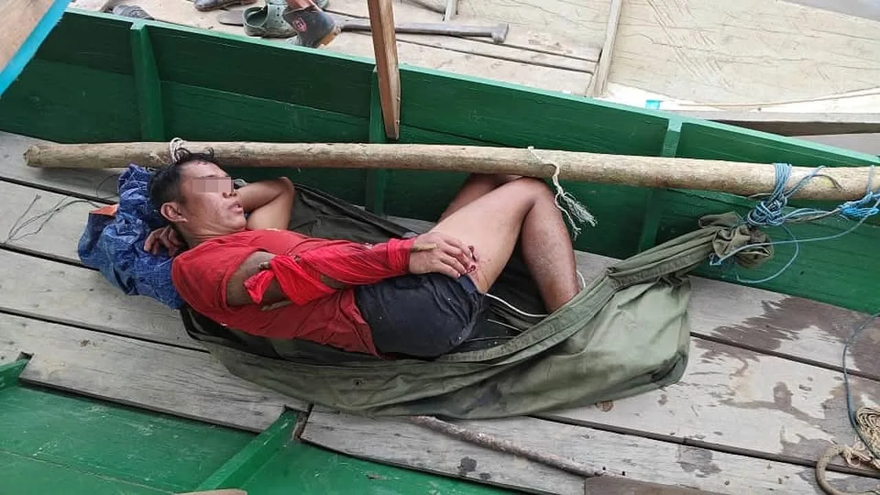 Lelaki Ini Selamat Dari Dibaham Selepas Cucuk Mata Mata Buaya