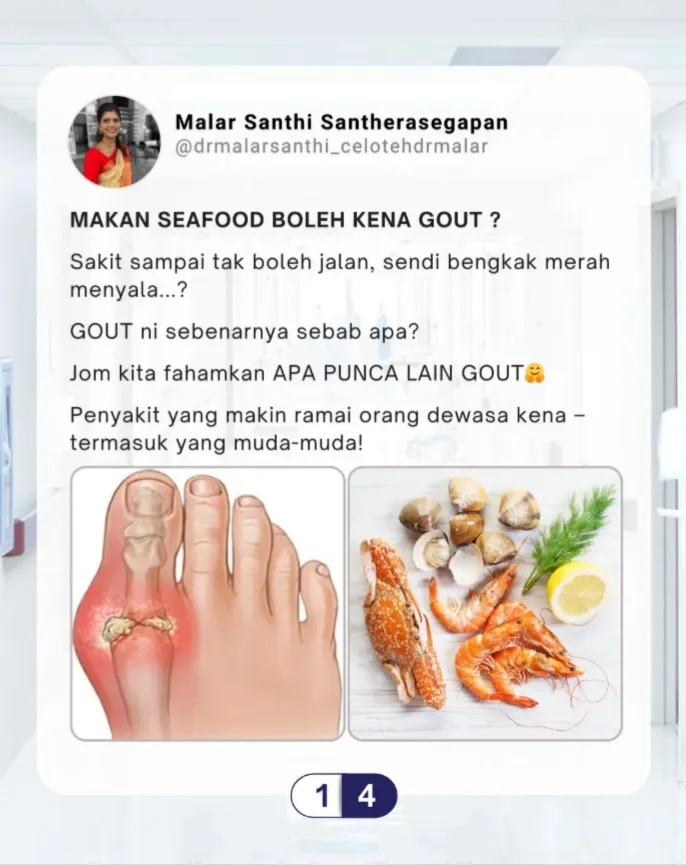Gout Bukan Sebab Seafood Semata, Dr Malar Dedah Punca Sebenar