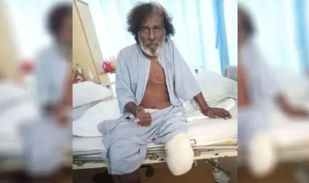 Sathiya Selamat Jalani Pembedahan Pemotongan Kaki, Kini Stabil