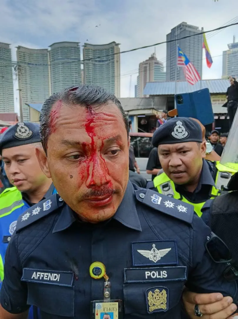 Serangan Terhadap Ketua Polis Dang Wangi Dikecam, PM Gesa Dalang Segera Diberkas