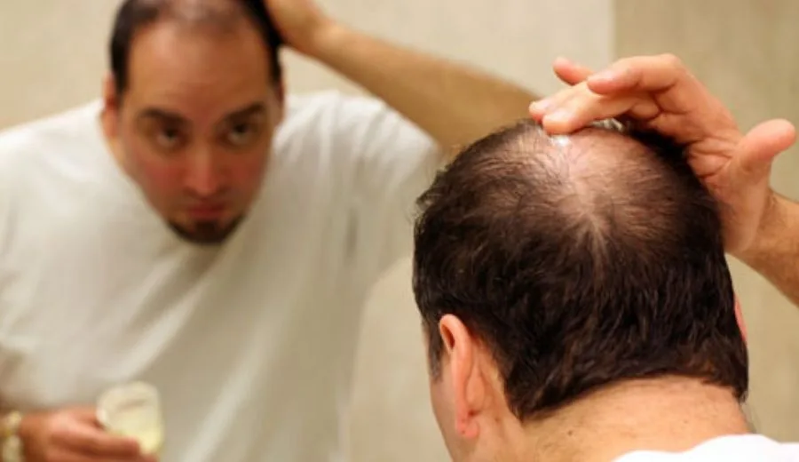 Rambut Gugur Sebab Pakai Helmet & Topi Terlalu Lama, Mitos atau Realiti?
