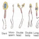 sperm_shapes